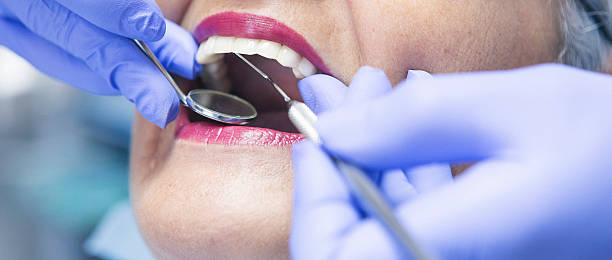 Best Emergency Tooth Extraction in Garden Grove, CA
